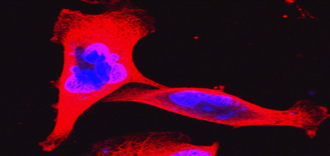 Cancer biology