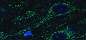 Neurobiologija i bolesti nervnog sistema